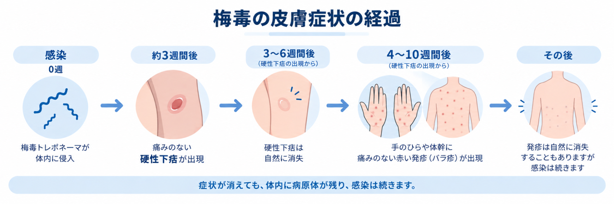 梅毒の皮膚症状の例