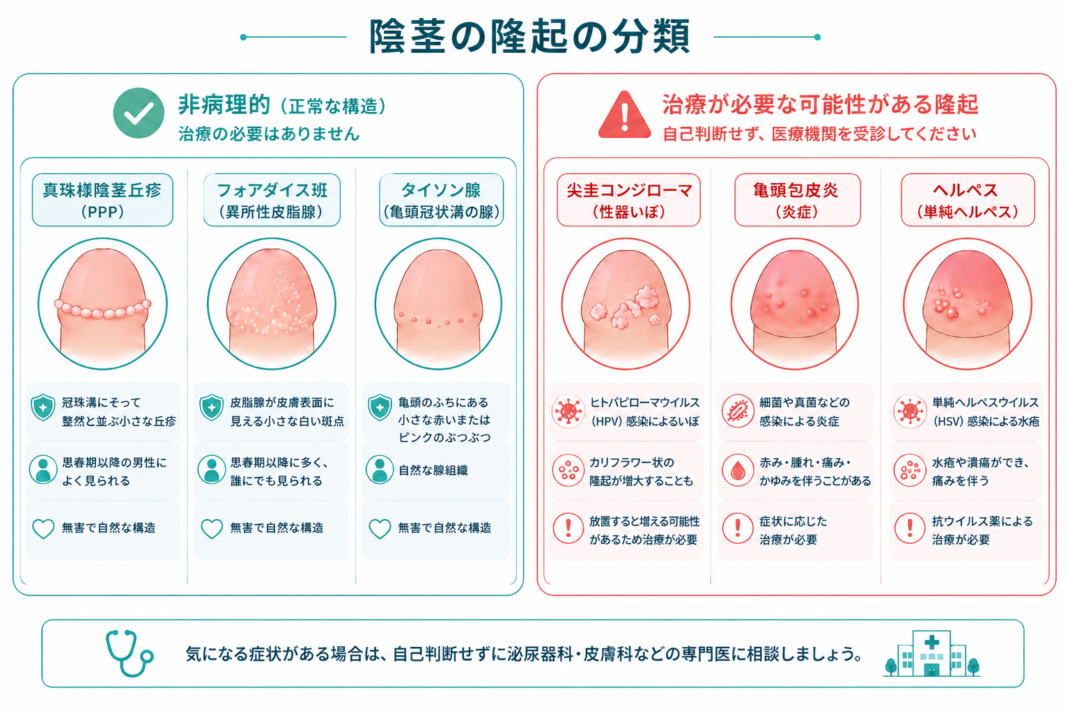 亀頭のぶつぶつの分類図（生理的なものと治療が必要なもの）